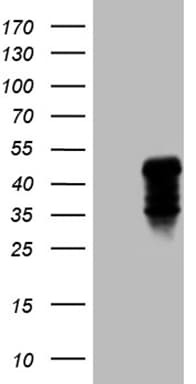 CLEC4M / L-SIGN / CD299 Antibody (aa74-329, clone OTI7D12)