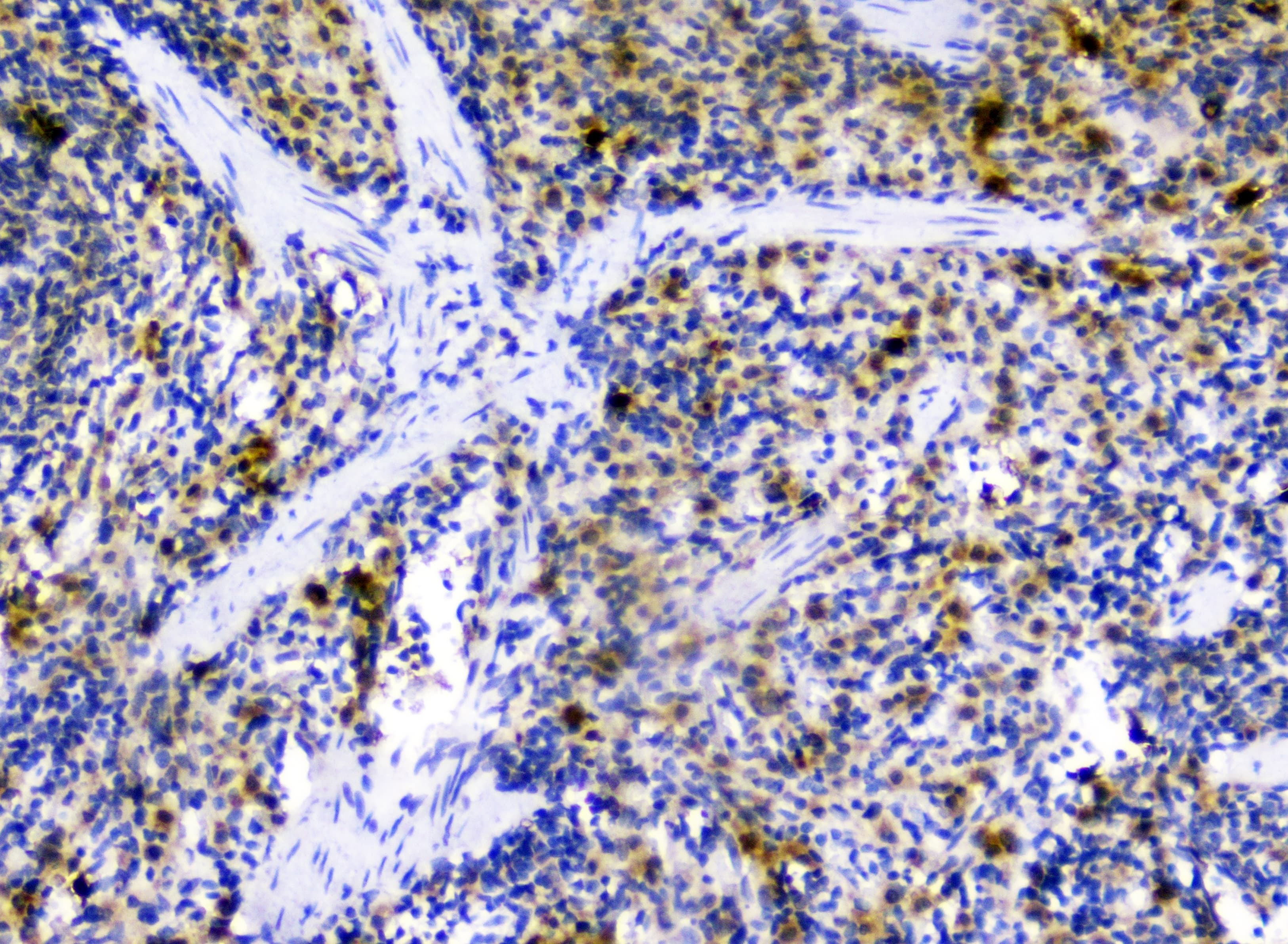 SDF1 / CXCL12 Antibody
