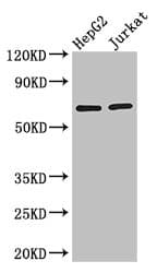 Polyclonal Rabbit anti-Human RUNX1T1 / ETO Antibody (IHC, WB)