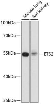 Polyclonal Rabbit anti-Human ETS2 Antibody (WB)
