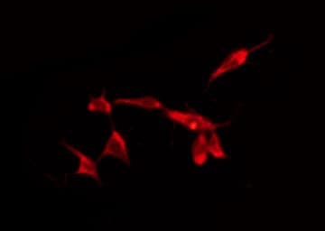 CADM2 Antibody
