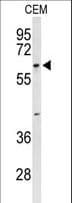 Polyclonal Rabbit anti-Human TCHP Antibody (aa291-320, IHC, WB)