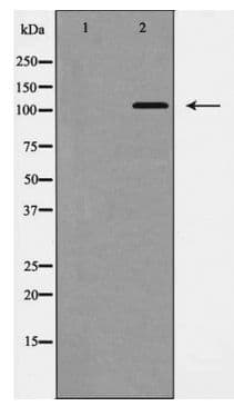 EPHB1 / EPH Receptor B1 Antibody