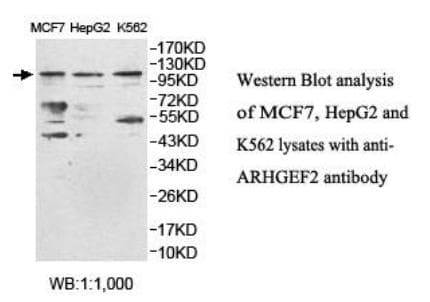 Polyclonal Rabbit anti-Human ARHGEF2 / GEF-H1 Antibody (aa633-805, WB)