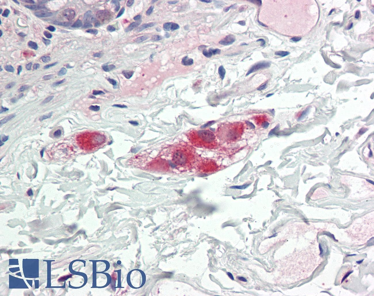 SCGN / Secretagogin Antibody (C-Terminus)