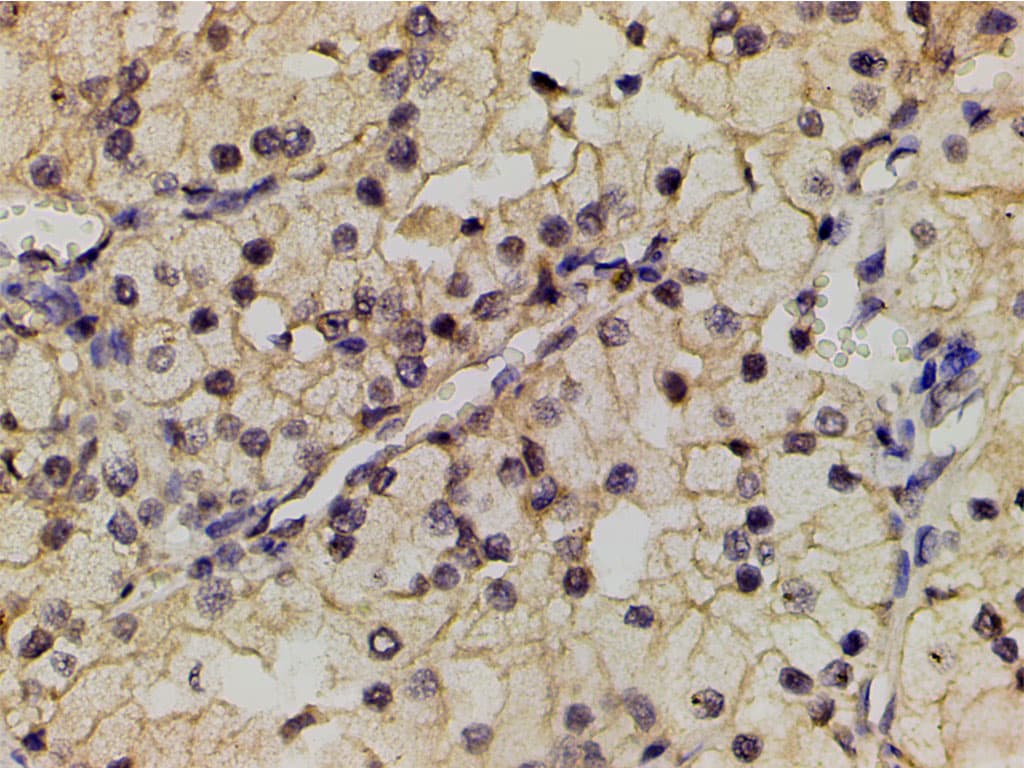 PIK3R1 / p85 Alpha Antibody (phospho-Tyr607)