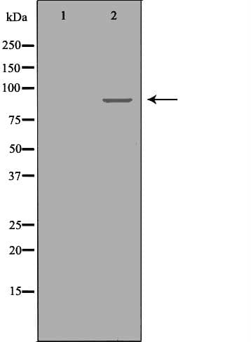 R1 / RRM1 Antibody