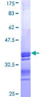 Human CTB / PCYT1B Protein (Recombinant GST, N-terminus)