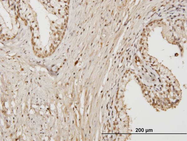 RAB17 Antibody (clone 2A10)