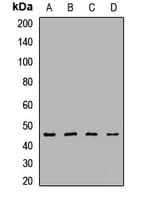 PIP4K2A / PIPK Antibody
