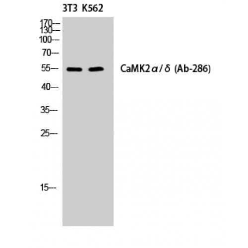 CaMKII Alpha+Delta Antibody (230-310 aa)
