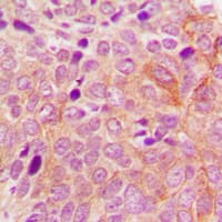 Polyclonal Rabbit anti-Human PRKD2 / PKD2 Antibody (C-Terminus, IHC, WB)