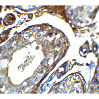 IQCF2 Antibody