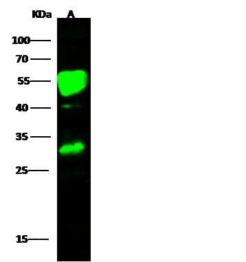 Polyclonal Rabbit anti-Human CCR2 Antibody (Preservative Free, IF, WB)
