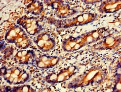 IHC-plus™ Polyclonal Rabbit anti-Human GPC1 / Glypican Antibody (IHC, IF)