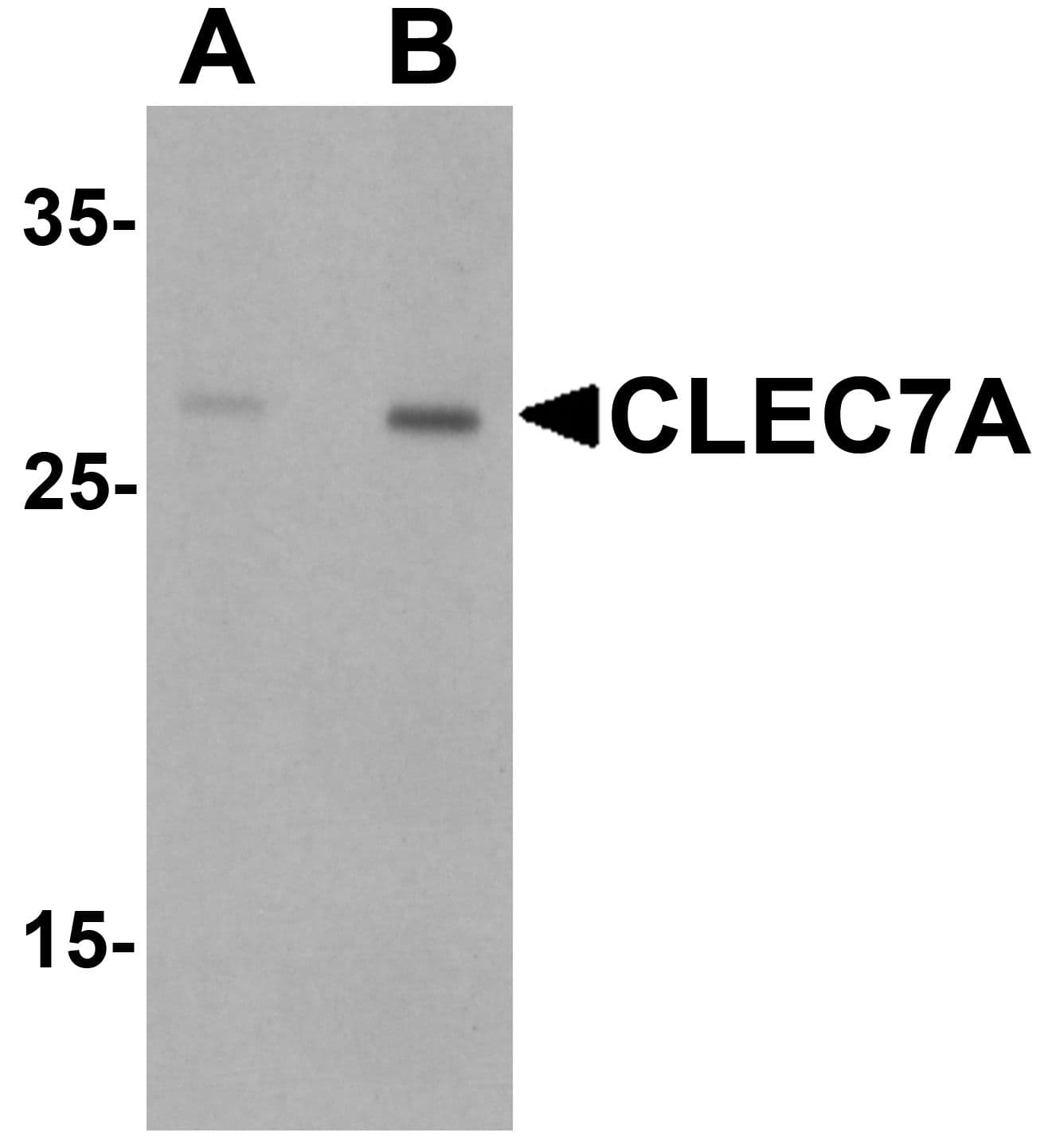 IHC-plus™ Polyclonal Rabbit anti-Human CLEC7A / Dectin 1 Antibody (IHC, IF, WB)