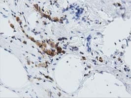 Monoclonal Mouse anti-Human ARHGAP25 Antibody (clone OTI11B9, IHC, IF, WB)