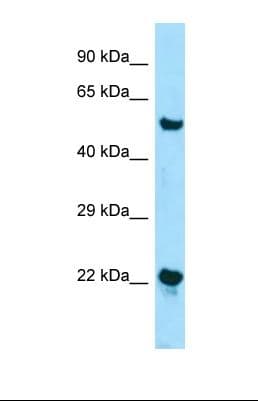 ZDHHC12 Antibody (aa69-118)