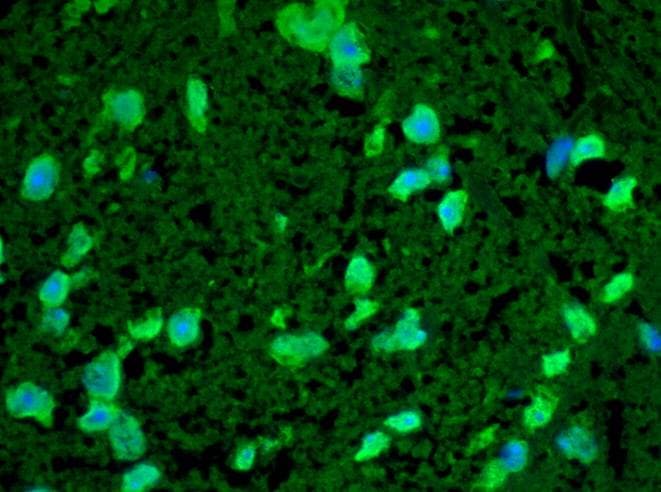 HSPB8 / H11 / HSP22 Antibody