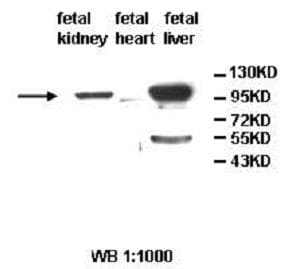 Polyclonal Rabbit anti-Human ALDH1L2 Antibody (aa2-247, IHC, WB)