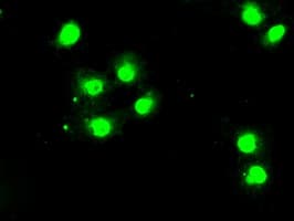 BUB1B / BubR1 Antibody (clone OTI11G2)