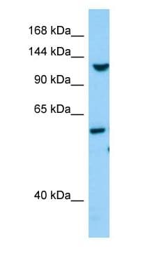 TLL1 Antibody (aa871-920)
