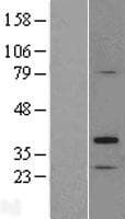 TP53TG5 Protein (Over-Expression Lysate Myc-DDK (Flag))