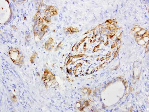 Monoclonal Mouse anti-Human L1CAM Antibody (clone UMAB48, IHC, IF, WB)