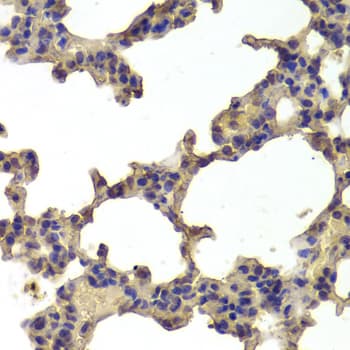 HDAC7 Antibody