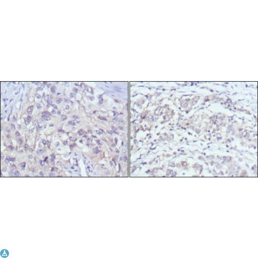 Monoclonal Mouse anti-Human PAK2 Antibody (IHC, IF, WB)