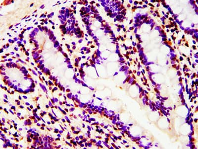 Polyclonal Rabbit anti-Human HIST1H4I Antibody (IHC, IF, WB)