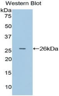APC Antibody (aa2634-2842, Cy3)