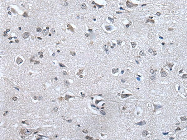 HAND1 Antibody