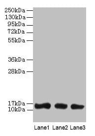 IHC-plus™ LGALS1 / Galectin 1 Antibody (aa2-135)