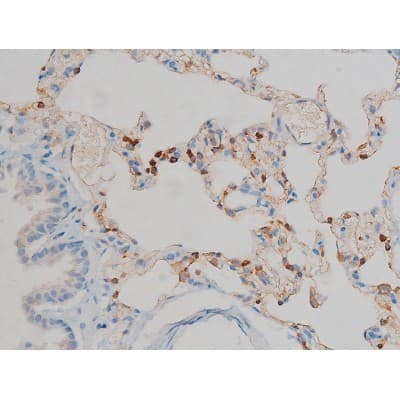MAPK3 / ERK1 Antibody (phospho-Tyr204,pThr202)