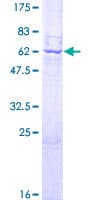 Human ACP5 / TRAP Protein (Recombinant GST)