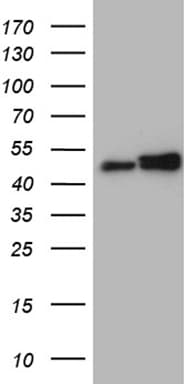 Monoclonal Mouse anti-Human HNRNPH1 / hnRNP H Antibody (clone OTI2E8, Carrier-free, IHC, WB)