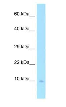 Polyclonal Rabbit anti-Human COX7C Antibody (C-Terminus, WB)