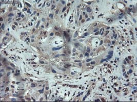 Monoclonal Mouse anti-Human APOM / Apolipoprotein M Antibody (clone OTI3H3, IHC, WB)