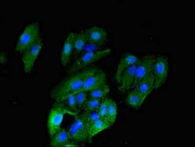 Polyclonal Rabbit anti-Human HRH1 / Histamine H1 Receptor Antibody (IHC, IF, WB)