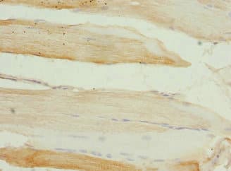 Polyclonal Rabbit anti-Human SGCD / Delta-Sarcoglycan Antibody (IHC, WB)