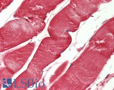 PathPlus™ Monoclonal Mouse anti-Human PARK7 / DJ-1 Antibody (clone 4H4, IHC, IF, WB)