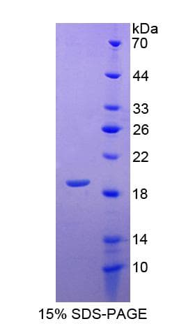 Human IL4 Protein (Recombinant His-T7)