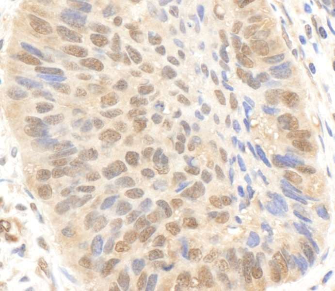 Polyclonal Rabbit anti-Human EP300 / p300 Antibody (aa950-1000, IHC, WB)
