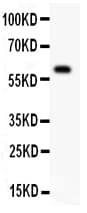 Polyclonal Rabbit anti-Human TNFRSF25 / DR3 Antibody (aa73-94, WB)