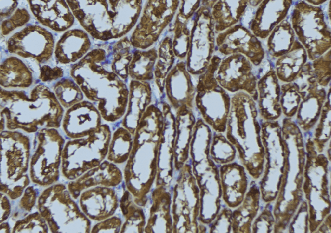 RAB34 Antibody