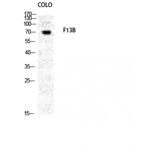 Polyclonal Rabbit anti-Human F13B / TGase Antibody (30-110 aa, N-terminal, IHC, IF, WB)