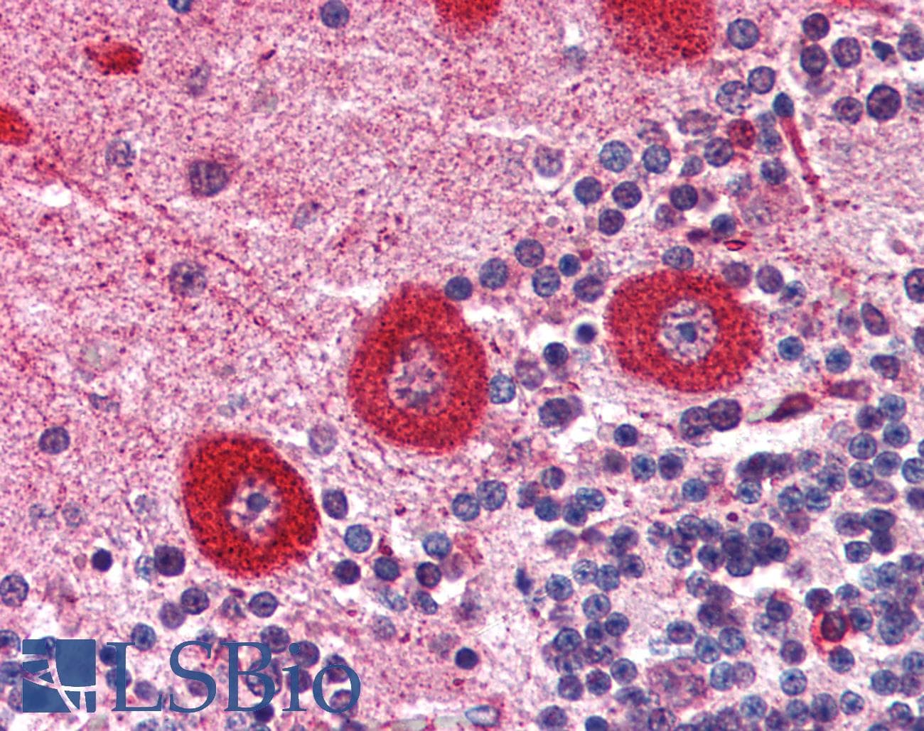 IHC-plus™ Polyclonal Rabbit anti-Human ITPR1 / IP3 Receptor Type 1 Antibody (C-Terminus, IHC, WB)