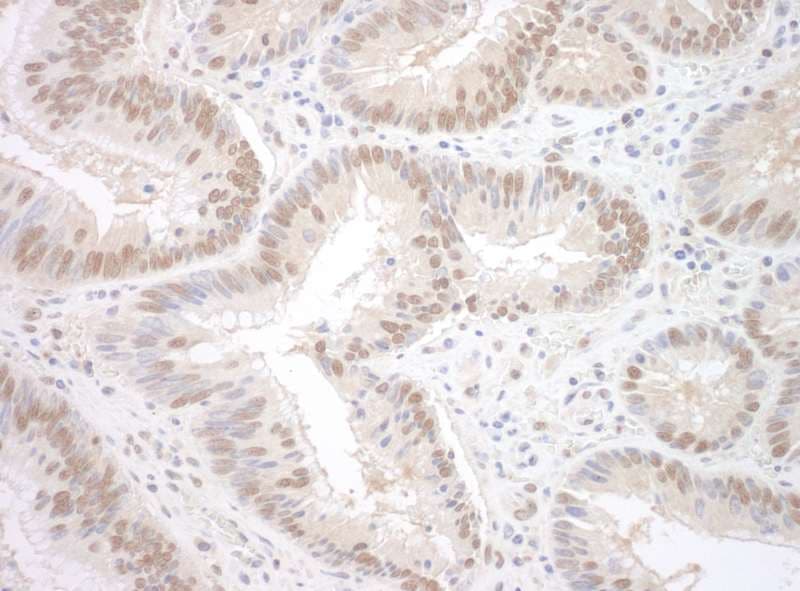 RBM17 Antibody (aa25-75)