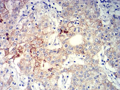 Monoclonal Mouse anti-Human ITGB4 / Integrin Beta 4 Antibody (clone 5G3G5, IHC, WB)